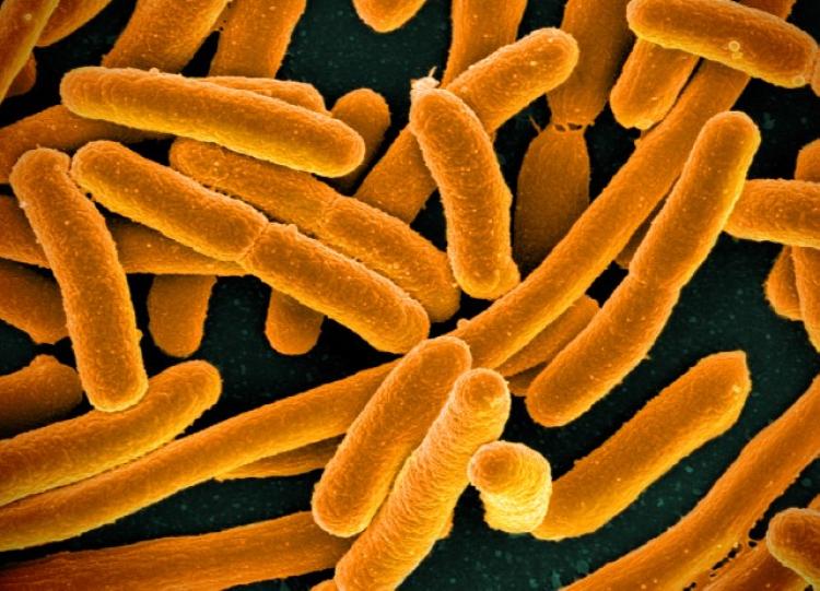 E. coli