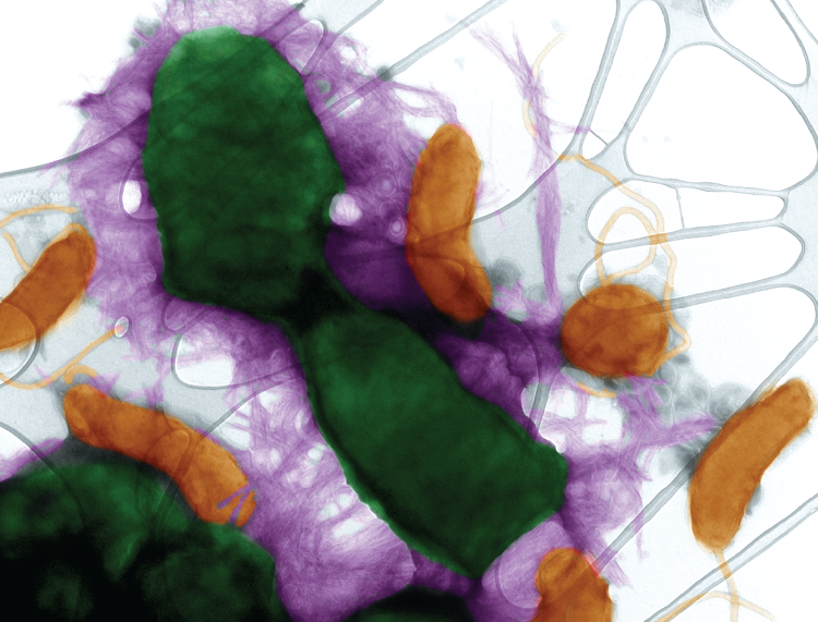 Transmission electron micrograph of E. coli against the predatory bacterium Bdellovibrio bacteriovorus.