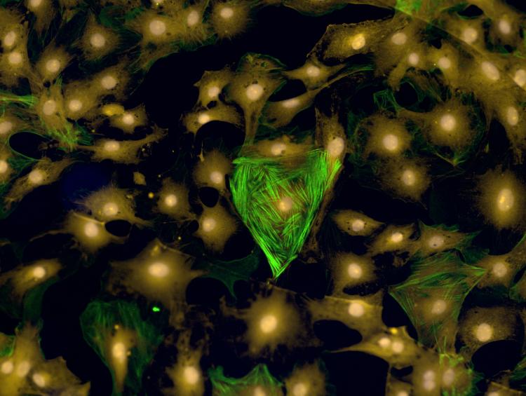 Picture of cardiac cells on a hydrogel