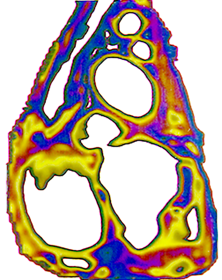 Digital representation of a cross-section of the heart