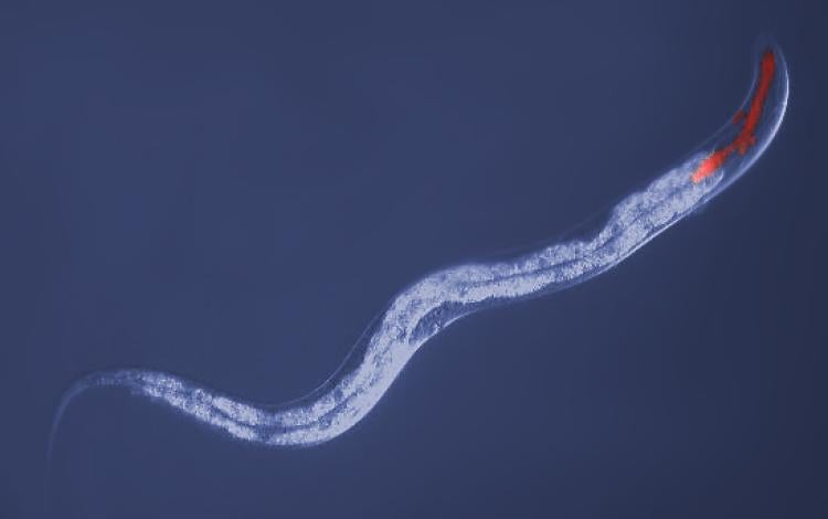 C Elegans under the microscope
