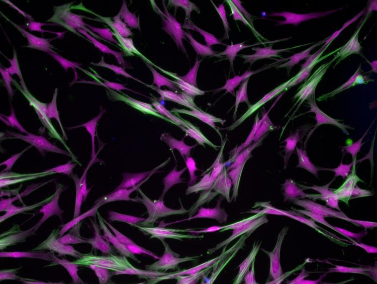 Valvular cells on a hydrogel