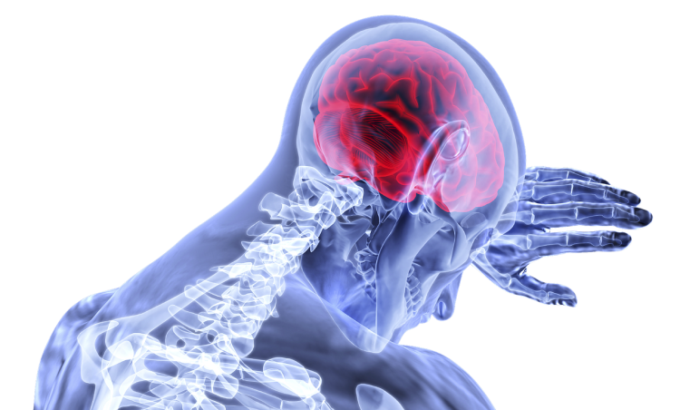 Graphic showing brain and skeleton