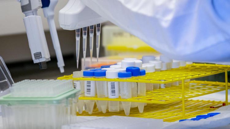 A tray of sample tubes filled with liquid