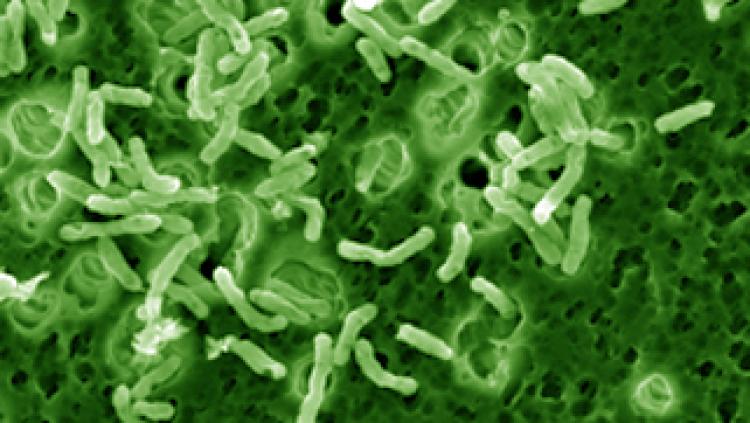 A green image of M. Vaccae under a microscope