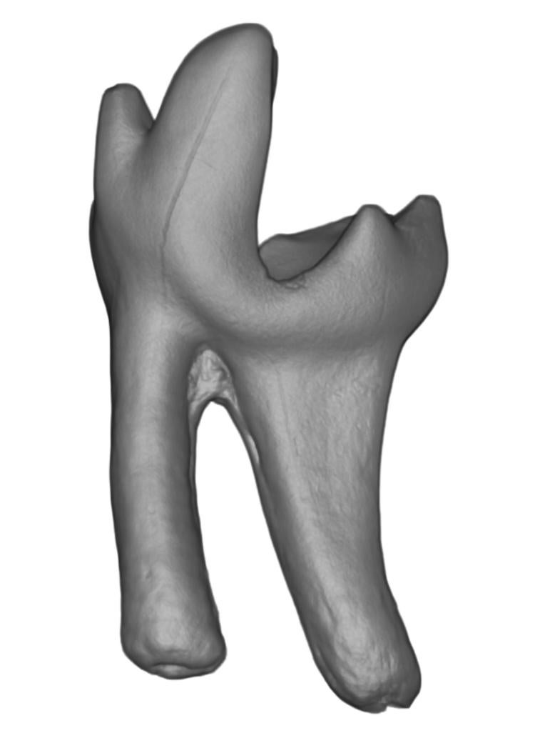 Digital scan of tooth