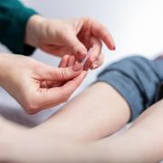 person receiving acupuncture