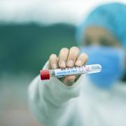 A nurse holding a test tube