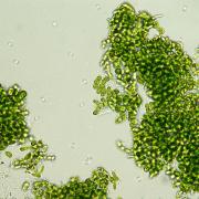 Green algae under the microscope