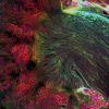 3D renderings of post-natal kidneys