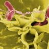 salmonella bacteria under a microscope