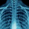 An x-ray image of a human skeleton