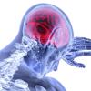 Red brain overlaid on skeleton