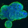 Three-dimensional culture of human breast cancer cells