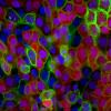 Skin cells glow under the microscope