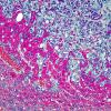 Tissue stained pink seen under a microscope