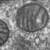 mitochondria from mammalian lung tissue