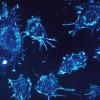Human cancer cells seen under the microscope