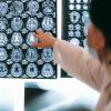 researcher examines brain scans