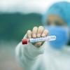 A nurse holding a test tube