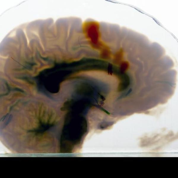 3D-printed image of a brain