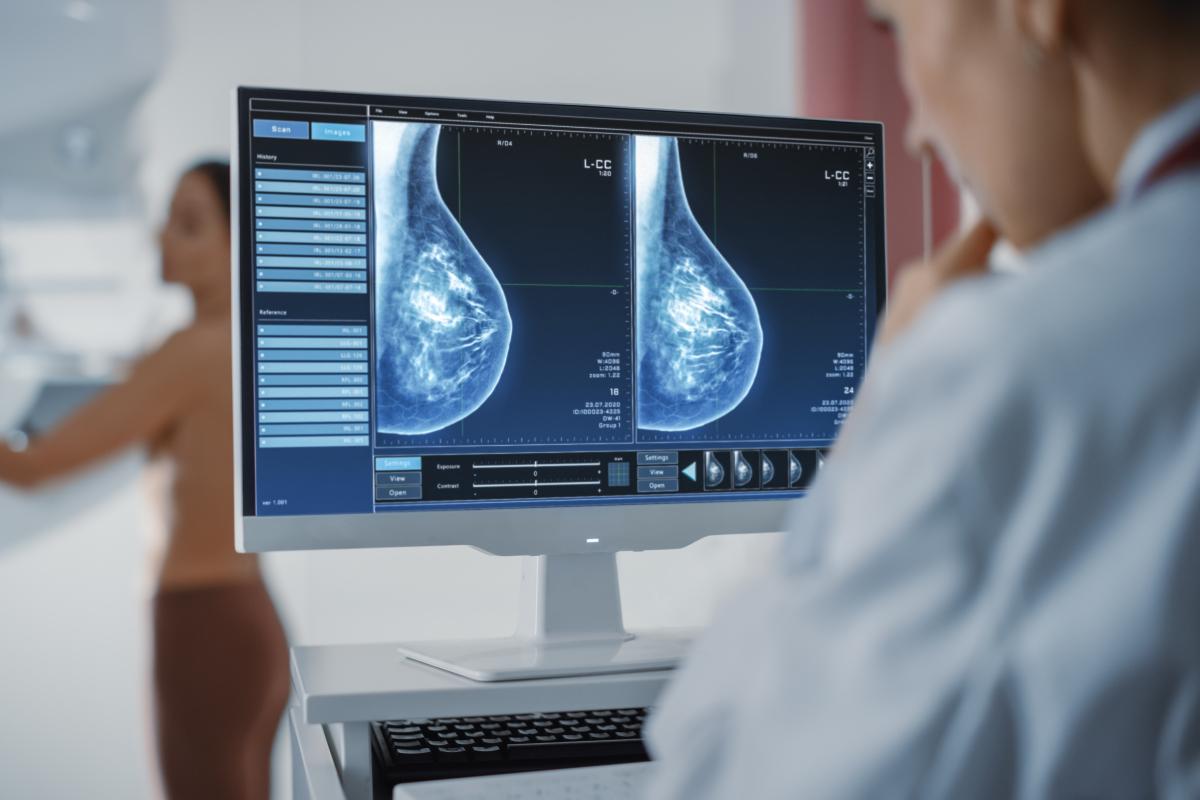 A doctor looks at a screen to detect breast cancer during a mammogram