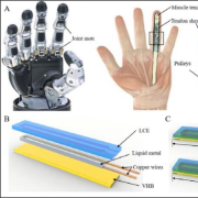 prosthetic hand diagram