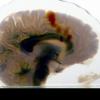3D-printed image of a brain